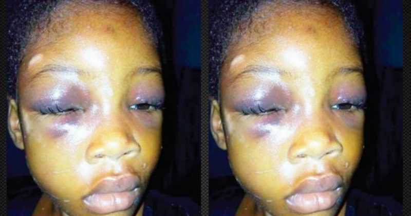 Couple Arrested For Brutalising A 5-year-old Girl That Lives With Them (photos)