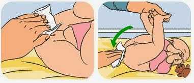 Diaper Rash: Five Questions Answered By Dermatologist