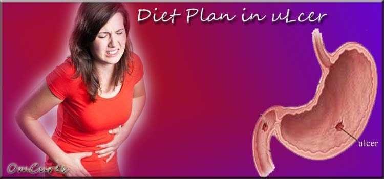 Diet Plan In Ulcer In Hindi | Peptic Ulcer होने पर इस Diet Plan को Follow करें