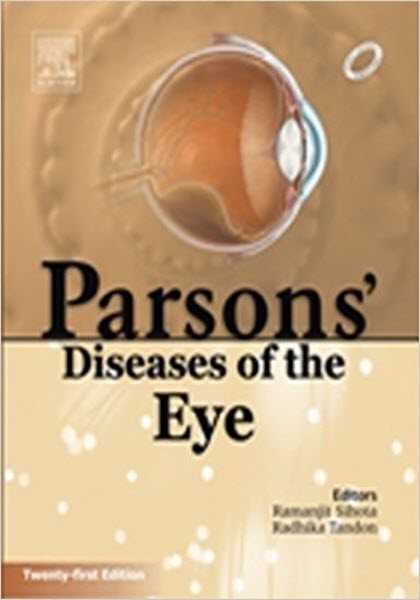 Download Parson’s Diseases Of The Eye Pdf Free With Review - Medical Study Zone