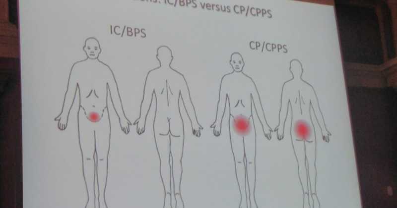 ESSIC 2017- Budapest