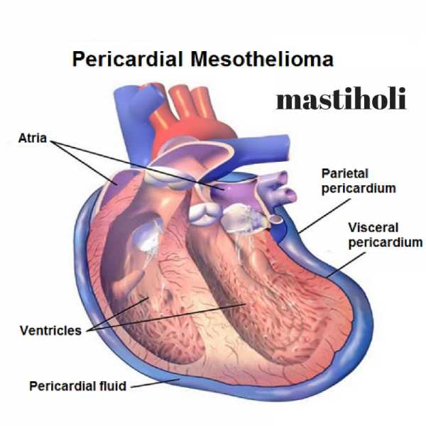 Early Signs Of Mesothelioma Case Study