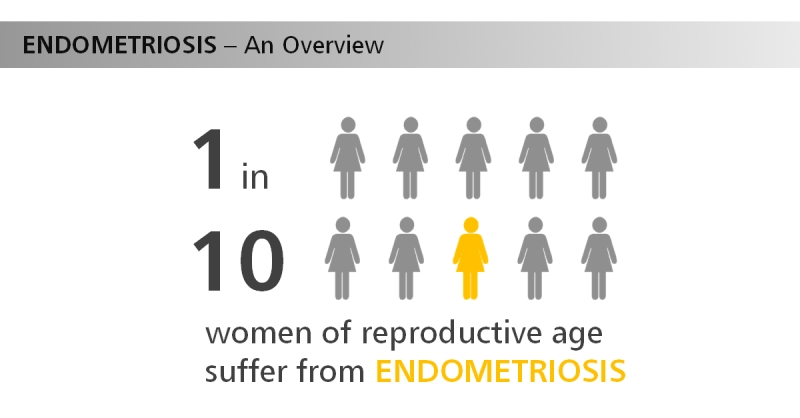 Endometriosis