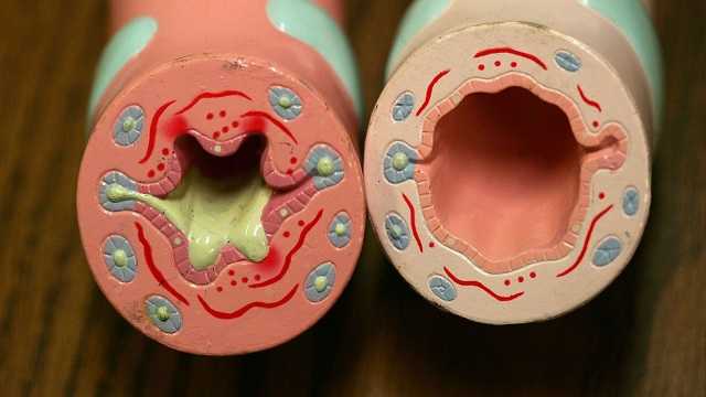 Fevipiprant: Leicester Scientists Trial New Asthma Pill