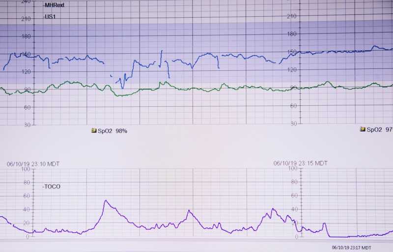 Future Of Cardiology Will Be Defined By Digital, Mobile Advances | UAE
