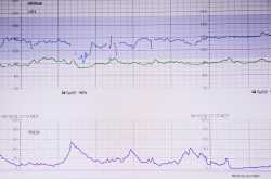 Future of Cardiology Will Be Defined by Digital, Mobile Advances | UAE