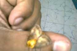 Golden Winged Beauty