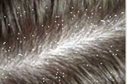 Granny Home Remedies