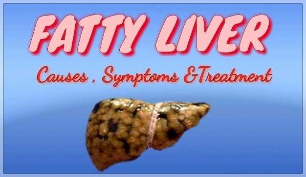 Health Corner For All: Fatty Liver : Know All About Causes, Symptoms, Prevention,Treatment