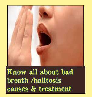 Health Corner For All: Know All About Bad Breath / Halitosis 