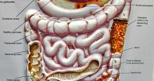 Health Care | घरेलु नुस्खे Present Digestion & Gas Problem Relief Home Remedy 