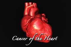 Heart cancer - a deadly problem & its treatment alternatives