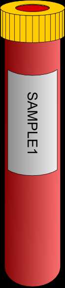 High Blood Sugar : Not So Sweet