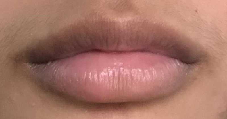 Home Remedies For Dark Lips