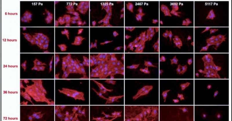 How Breast Cancers Grow And Metastasize