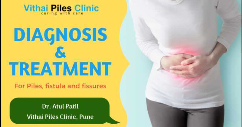How Doctor Diagnose Piles (Hemorrhoids) 