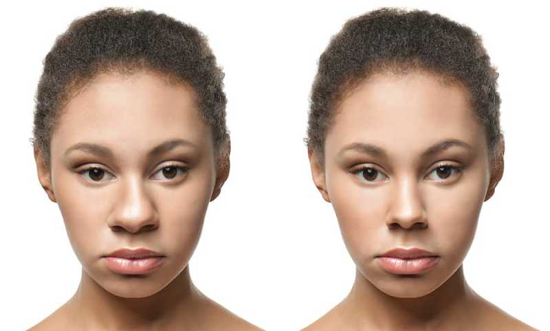How Ethnic Rhinoplasty Can Benefit You