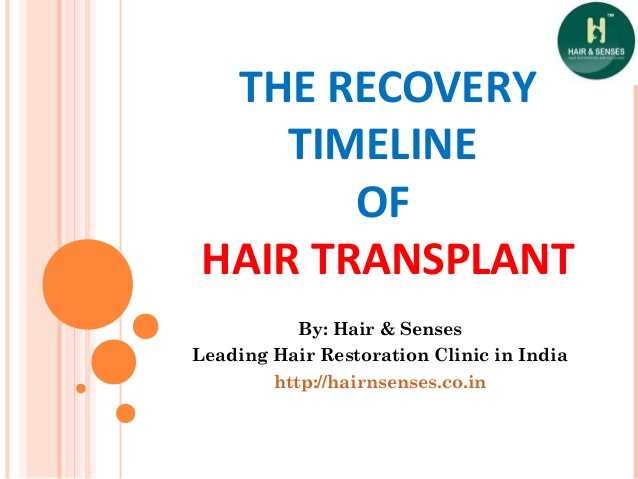 How Recovery Happens After Hair Transplant?