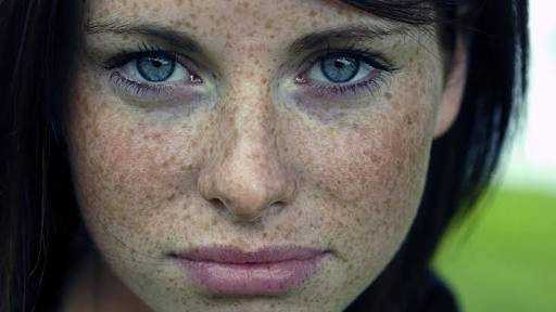 How To Get Freckles Naturally