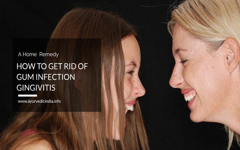 How To Get Rid Of Gum Infection Gingivitis Naturally At Home