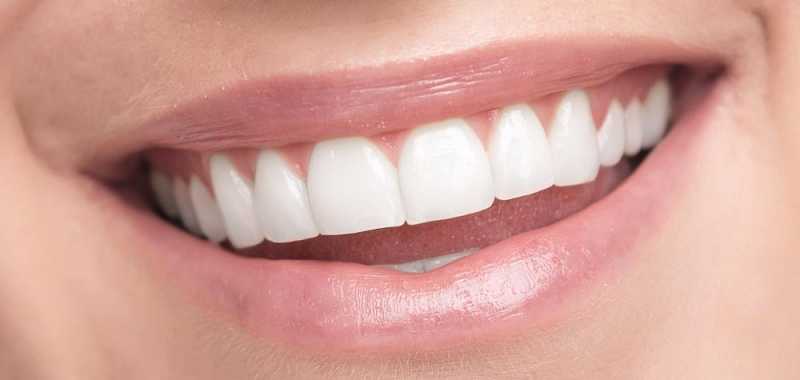 How To Keep Your Teeth White After Whitening
