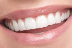 How To Keep Your Teeth White After Whitening