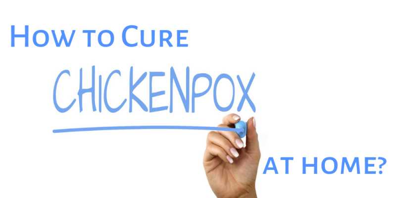How To Cure Chicken Pox At Home?