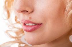 How to Get Rid of Moles on Your Face Naturally | The Facial Fitness - The Ultimate Skin Care Routine Guide