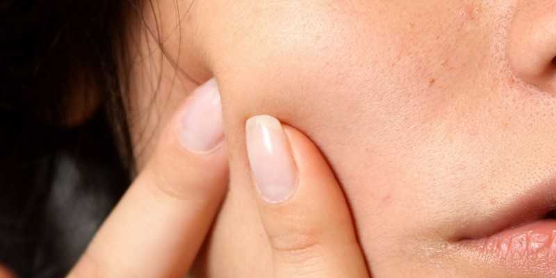How To Get Rid Of Acne: Best Food To Eat » Healthilicious Plate