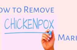 How to Remove Chicken Pox Marks at Home?