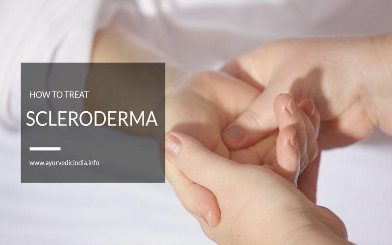 How To Treat Scleroderma Symptoms Naturally