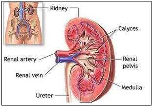 How To Avoid Kidney Stones