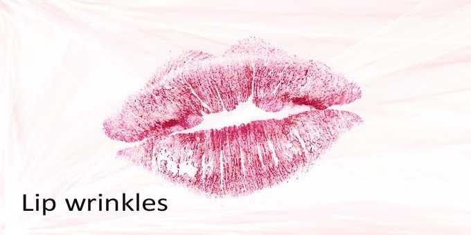How To Get Rid Of Lip Wrinkles And Lip Lines | Lynnai STYLE