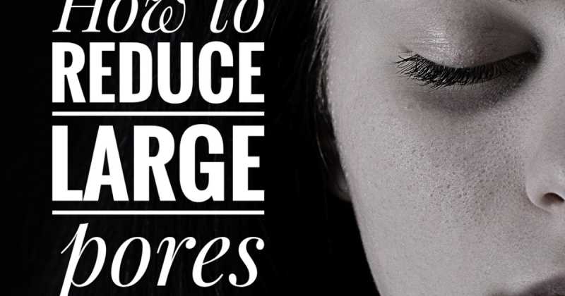 How To Reduce Large Pores On Face, Nose Or Cheeks