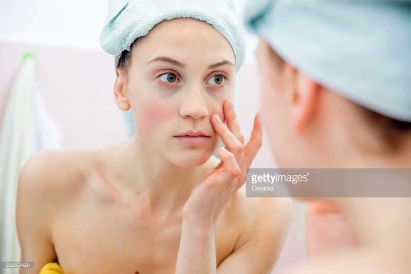 How To Remove Dark Circles At Home - Handbags For Women