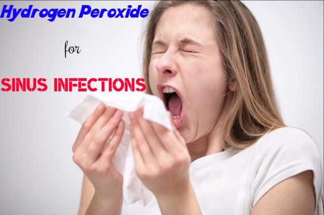 Hydrogen Peroxide For Sinus Infections:How Effective It Is? - Stylish Walks