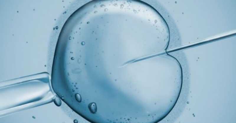 IVF Tips For Successful Procedure