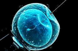 In Vitro Fertilization: Procedure, Success Rates And Side Effects