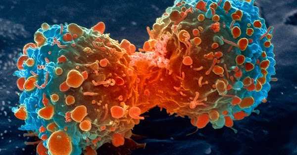 In The Battle Against Cancer, Microbes Could Be The Answer