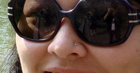 Is Invisalign The New Plastic Surgery?