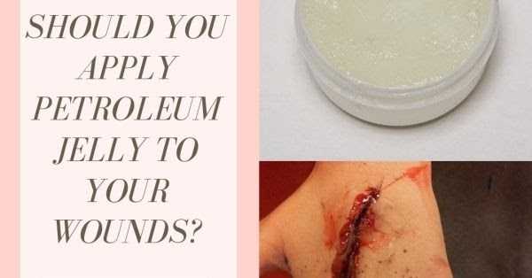 Is Petroleum Jelly Suitable For Cuts And Wounds?