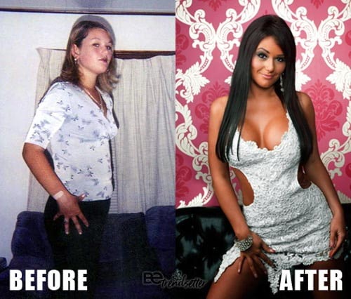 Jennifer Lynn Farley (Jwoww) Plastic Surgery Before And After