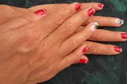 Know your health by reading Nails