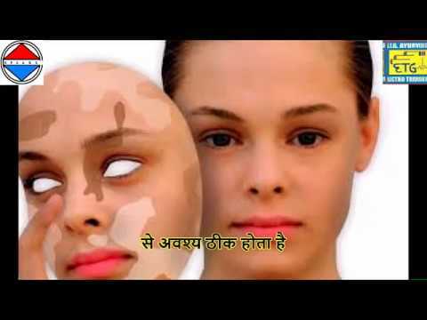 LISTEN LIVE STREAMED VIDEOS BY DR D.B.BAJPAI BROADCASTER CHANNEL