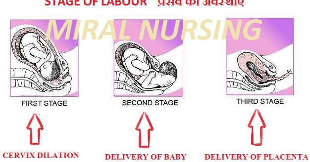 Labour à¤ªà¥à¤°à¤¸à¤µ 