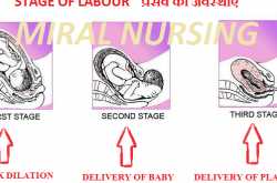 Labour à¤ªà¥à¤°à¤¸à¤µ 