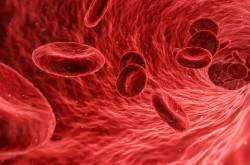 Lowering Blood Cholesterol Levels Avoids Coronary Heart Disease Risk - Cholesterol Fighter