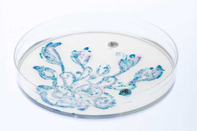 Microbes Living In Different Parts Of Human Body Can Still Swap Genes - LET ME SHOUT