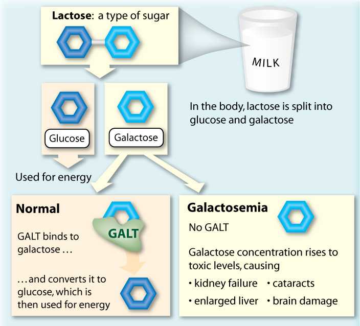 Most Common Enzyme Deficiency Responsible For Galactosemia Is: