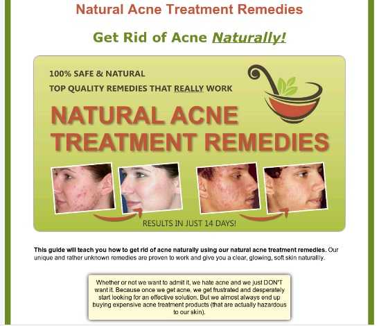 Natural Acne Treatments That Works